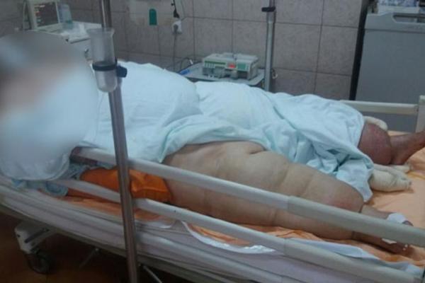 IPAK NIJE IZDRŽALA: Posle teške borbe za život preminula žena iz Bora teška 300 kilograma!