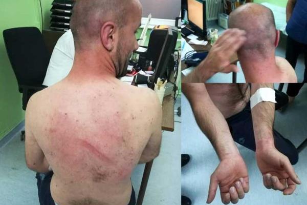 POLICIJA IH BRUTALNO IZMLATILA: Predsednik ove srpske opštine osudio ovaj događaj!