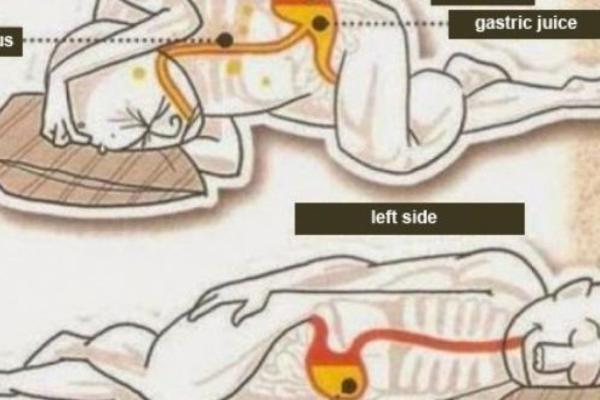 NIKAKO NEMOJTE SPAVATI NA OVOJ STRANI, MOŽE BITI OPASNO PO ŽIVOT: Utiče na srce i protok krvi! OTEŽAVA PROBAVU!