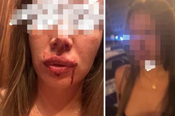 Ovo je muškarac koji je brutalno pretukao devojku (26) na Novom Beogradu: Policija traga za nasilnikom (FOTO)